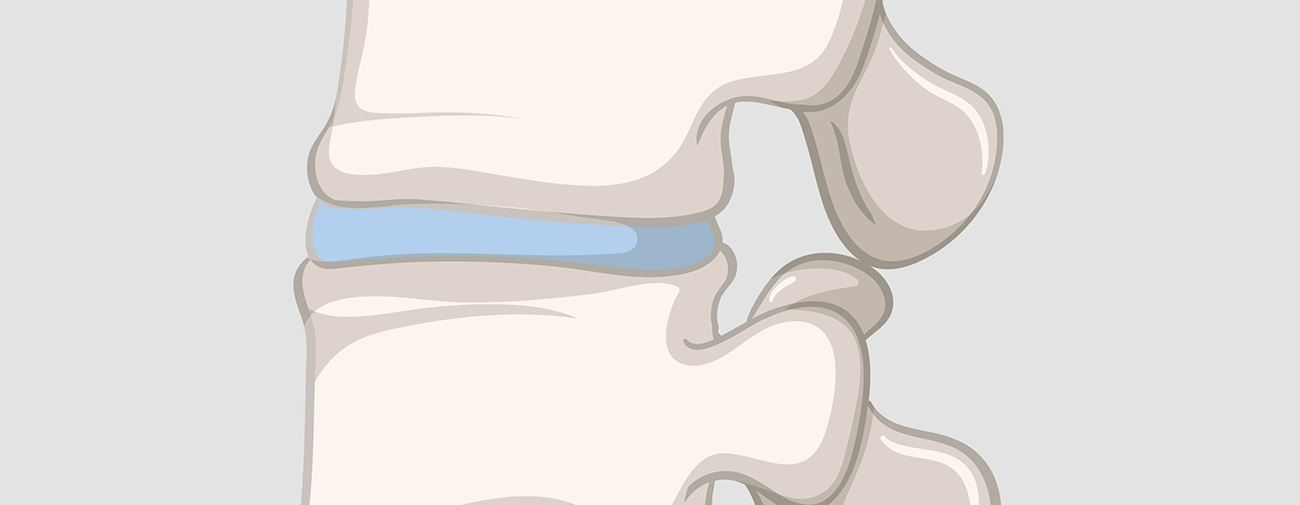 intervertebral disc anatomy