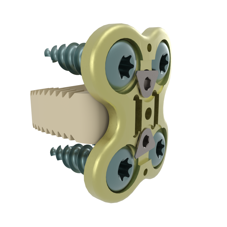 Cervical plate ACIFBOX