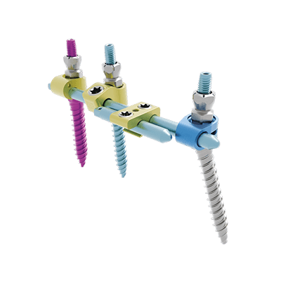 Side-loading posterior osteosynthesis system KAPHORN