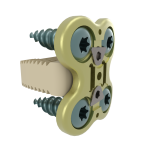 Cervical plate ACIFBOX