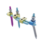 Side-loading posterior osteosynthesis system KAPHORN
