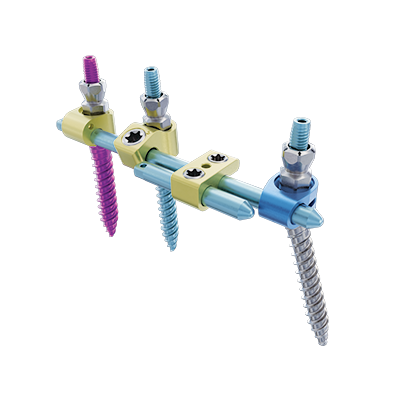 Side-loading posterior osteosynthesis system KAPHORN